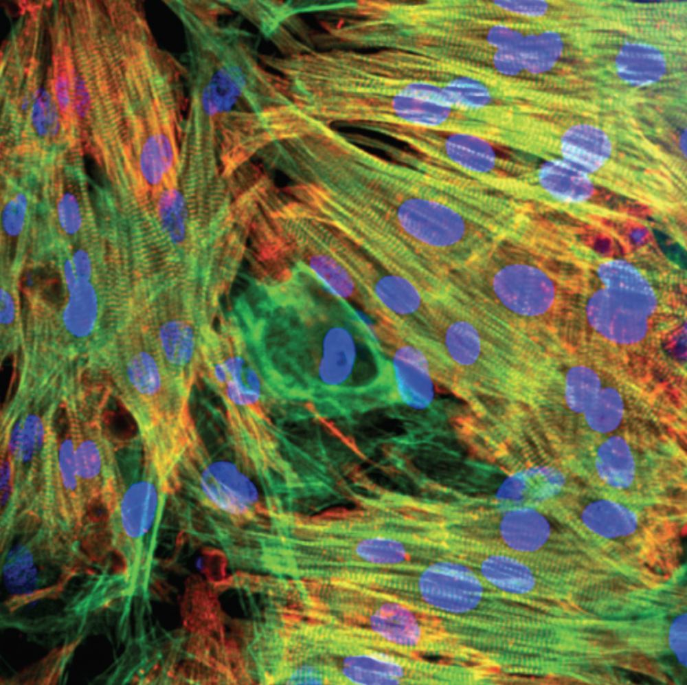 iPSC-CM / conventional