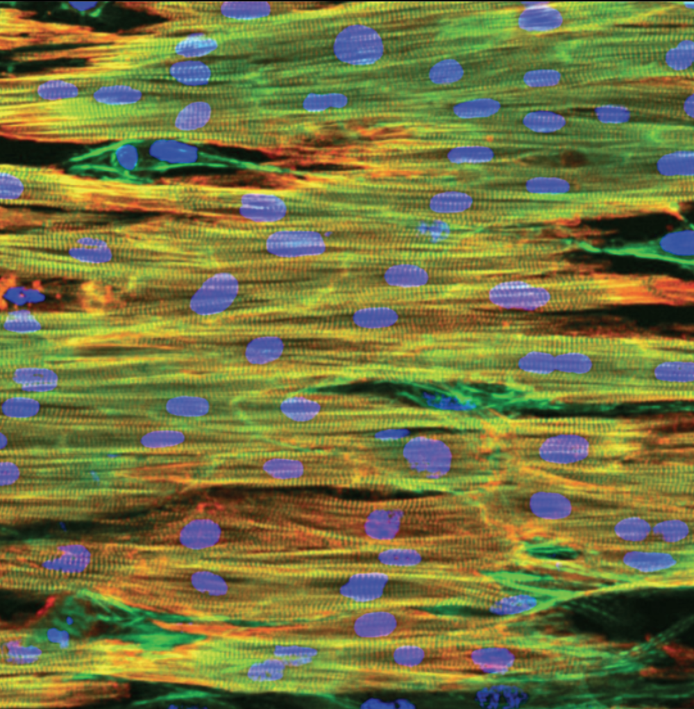 iPSC-CM / NanoSurface